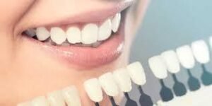 Cosmetic Dentistry in Sunlight Colony